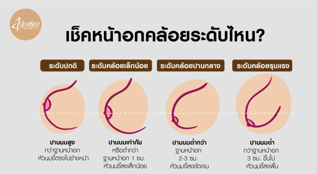 เสริมหน้าอก ปลอดภัยไหม ต้องเช็คอะไรบ้าง